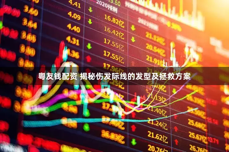 粤友钱配资 揭秘伤发际线的发型及拯救方案
